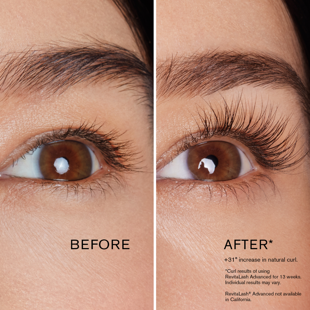 Before and After Revitalash treatment, available at Dr Preema London Clinic, Mayfair