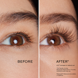 Before and After Revitalash treatment, available at Dr Preema London Clinic, Mayfair